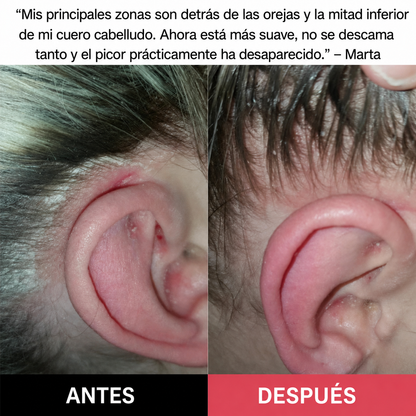Exfoliante revitalizante y reparador para el cuero cabelludo | 200 ml