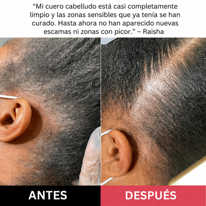 Exfoliante revitalizante y reparador para el cuero cabelludo | 200 ml